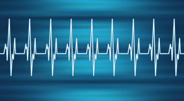 Electrocardiogram