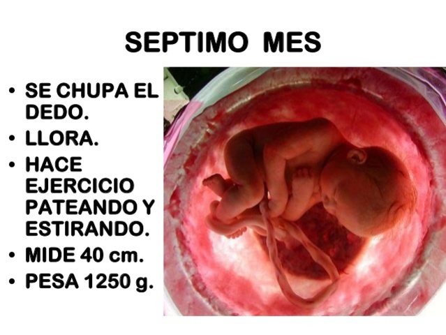 28a. Semana (7 meses)