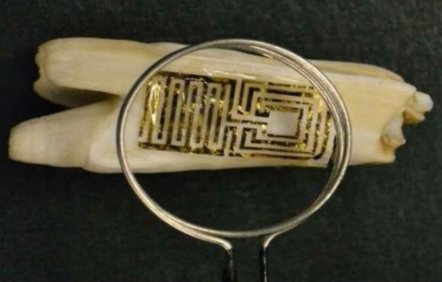 Зубной датчик