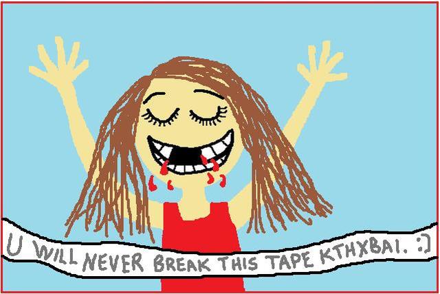 Je perdu mes deux dents de devant.