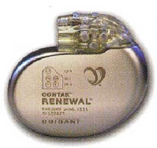 First totally internal pacemaker