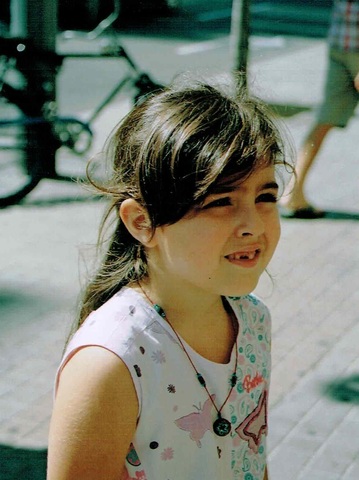 I LOST MY MILK TEETH