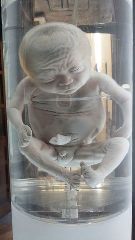 Feto 26 a 29 semanas