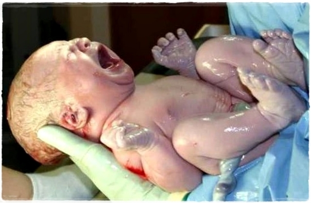 NACIMIENTO (NEONATO)