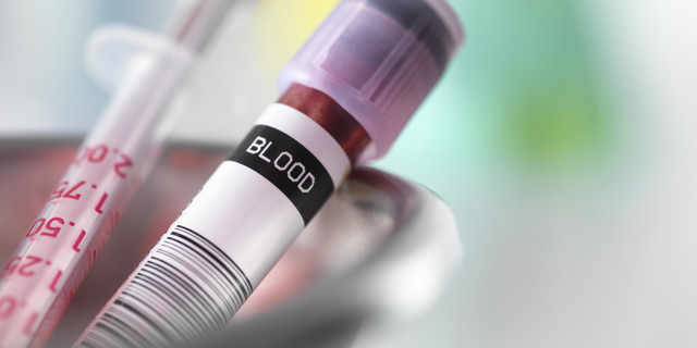 Most  diseases are  found through blood testings today