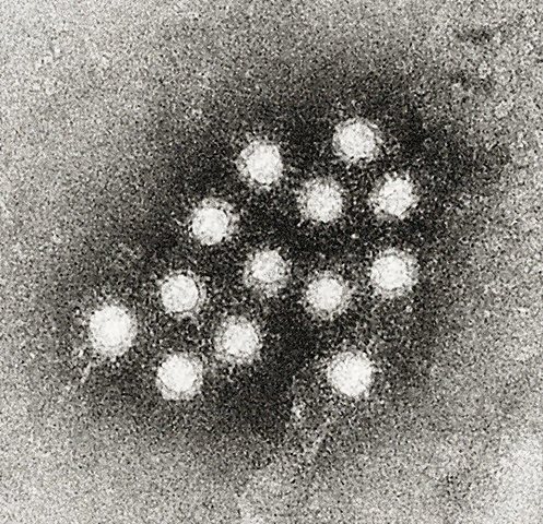 First case of Hepatitis A was found