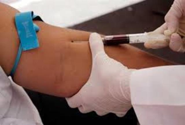 First commercial blood tests were licened for AIDS.