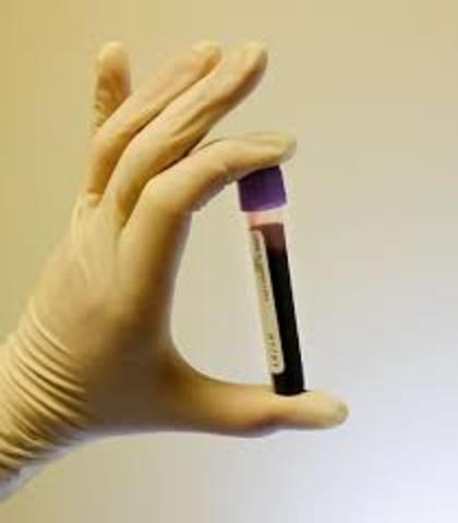 First diagnose of AIDS