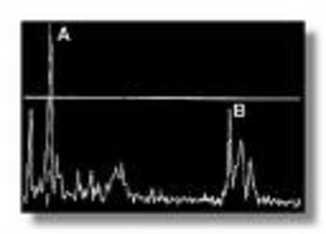 A-mode ultrasound is primarily used.
