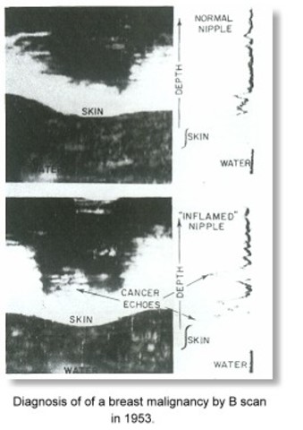 Dr. John Wild and John Reid perform the first breast ultrasound