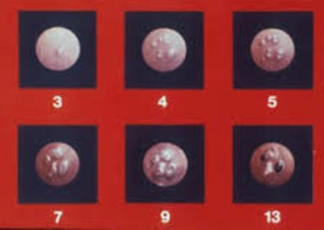 Potection from smallpox