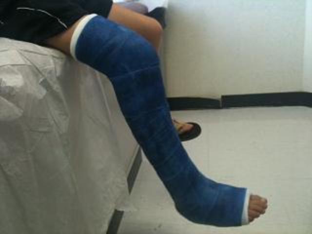 Hospital, I was running and broke my ankle