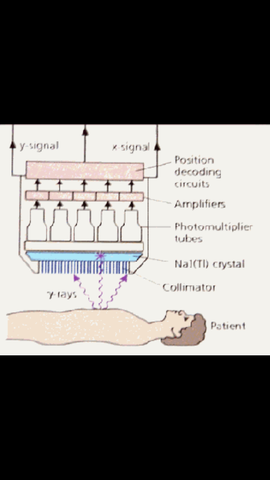 scintillation camera