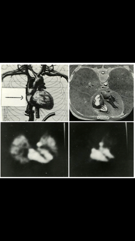 PET transverse section instrument