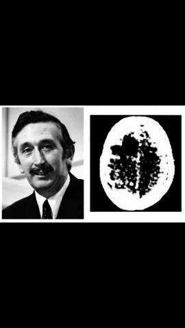 Prototype CT scanner