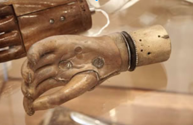 Prosthetics Arm