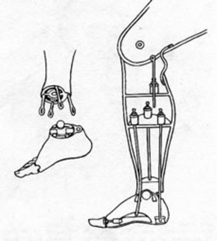Doctor Bly's Leg