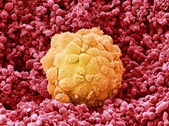 Implantación Blastocisto