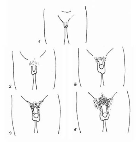 Desarrollo de los genitales en varones