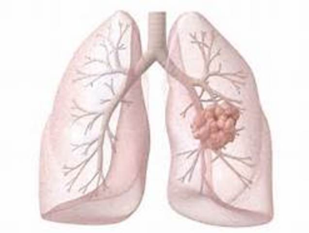 Baba dies because of lung cancer