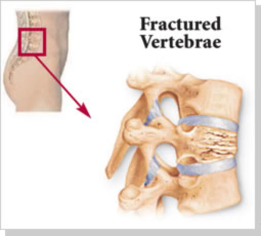 WW1 Veteran Database Collection Research