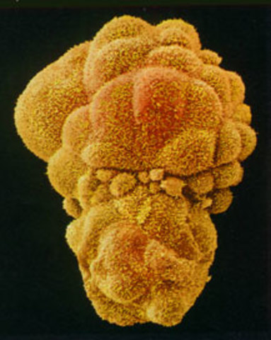 Día 12-Mesodermo extra embrionario