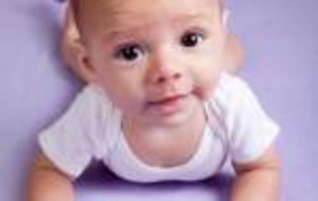 3 meses (lactante menor)