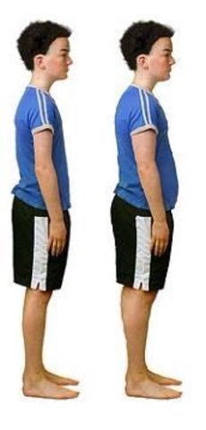 CAMBIOS EN LA PUBERTAD