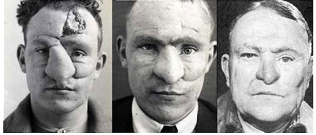 Successful Plastic Surgery