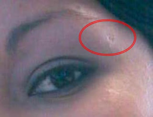 I fell and hit  in a cabinet