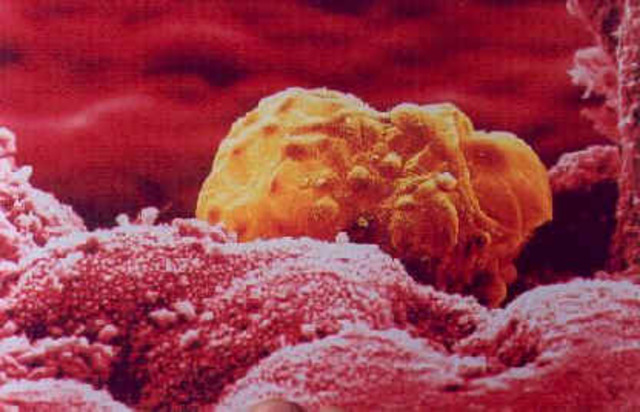 Preparación para el embarazo