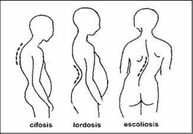 Fines de los dos años
