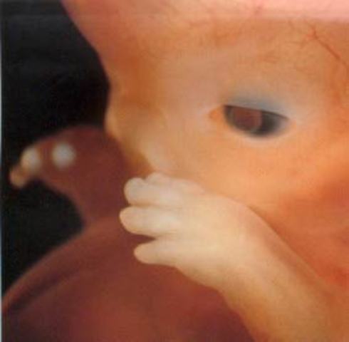 Formación de sentidos y extremidades