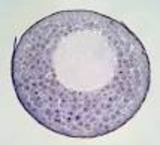 Blastula