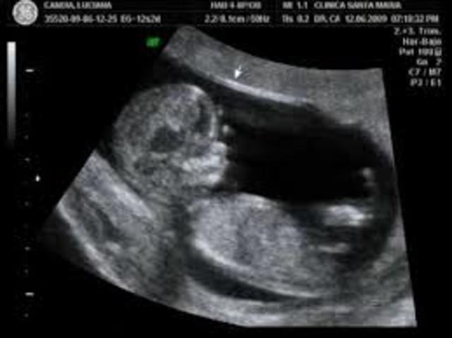 12a SEMANA-TERCER MES