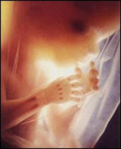 Semana 10 (semana 12 gestacional)