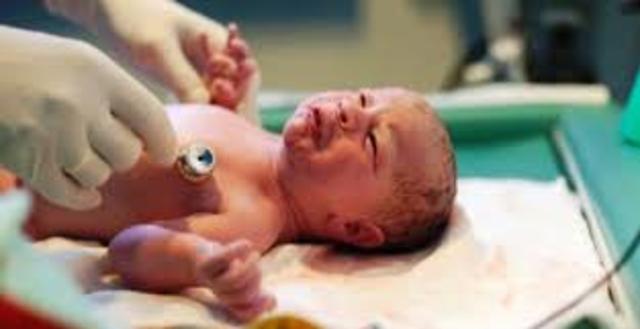 Neonato (1 dia de nacido- 30 días)