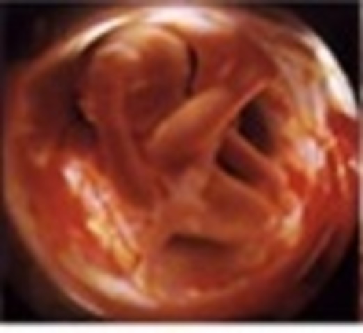 Semana dieciséis (4° mes)