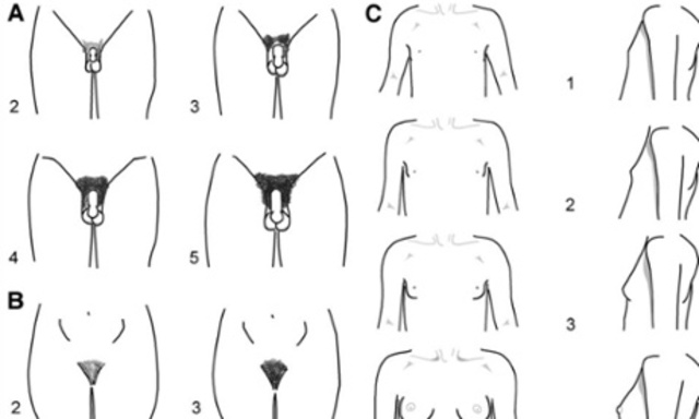 Pubertad en Hombres (12-15 años)