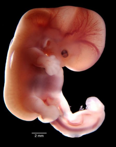ETAPA FETAL.