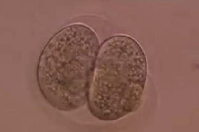 Semana 1 "Segmentación"