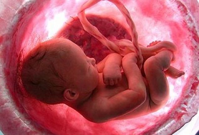 9 Meses, Carcaterísticas externas