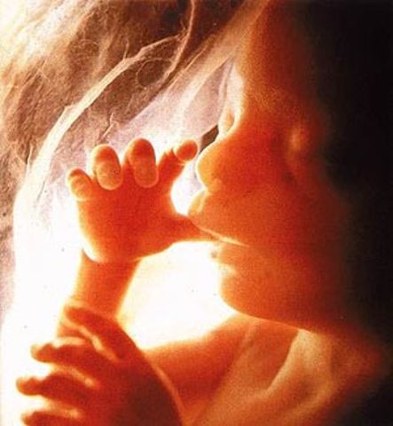 5 Meses, Carcaterísticas externas