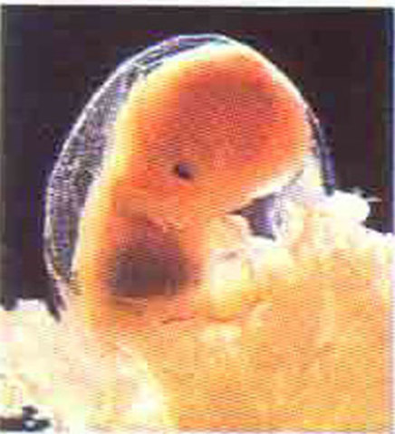 Desarrollo embrionario y fetal