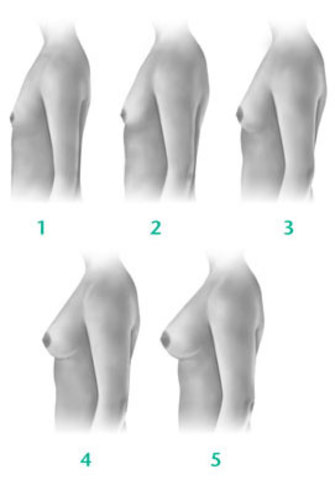 Inicio de desarrollo en los senos.