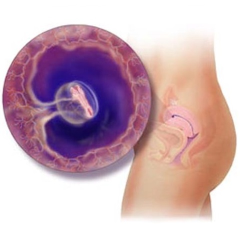 DISCO EMBRIONARIO TRILAMINAR