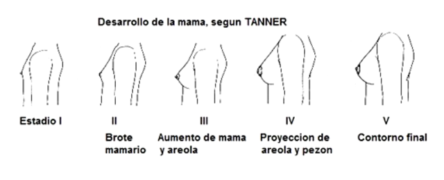 Desarrollo de la mujer