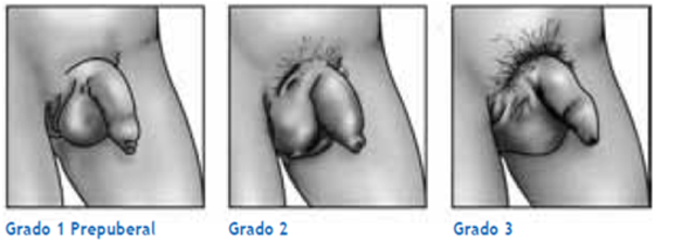 Primer Cambio Puberal (HOMBRES)