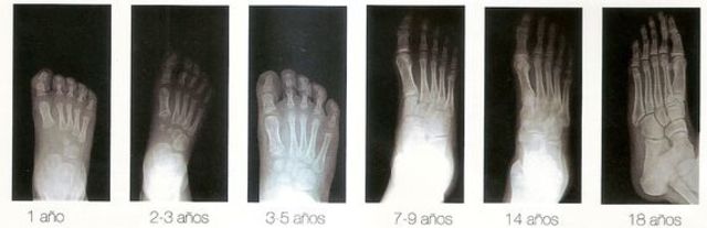 Desarrollo Óseo y Muscular