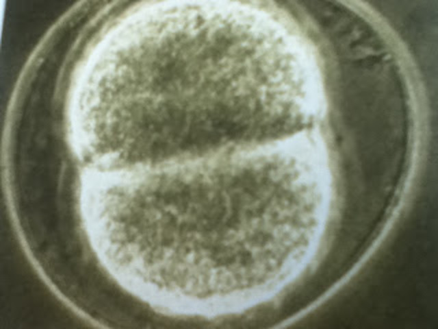 Cigoto-Segmentación